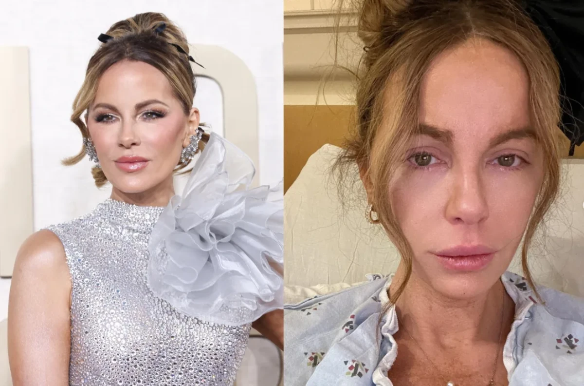 Kate Beckinsale a partagé des photos alarmantes sur Instagram, révélant son hospitalisation dans un état méconnaissable. Les détails chocs et les réactions des fans à découvrir ici.