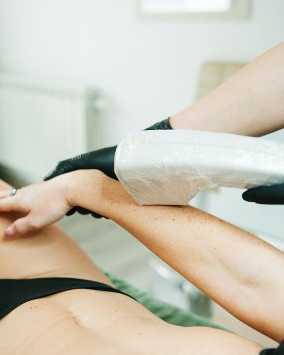 choisir-centre-epilation-laser-580