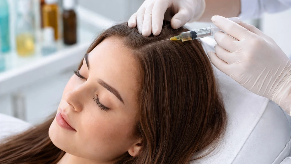 La mésothérapie capillaire est-elle efficace pour lutter contre la chute de cheveux ?