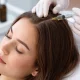La mésothérapie capillaire est-elle efficace pour lutter contre la chute de cheveux ?