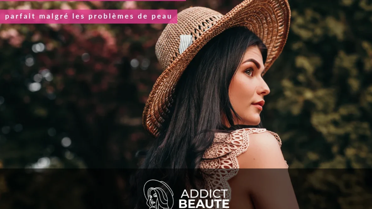 Remedes-naturels-pour-obtenir-un-teint-parfait-malgre-les-problemes-de-peau