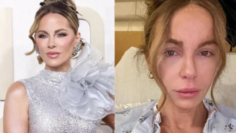 Kate Beckinsale a partagé des photos alarmantes sur Instagram, révélant son hospitalisation dans un état méconnaissable. Les détails chocs et les réactions des fans à découvrir ici.