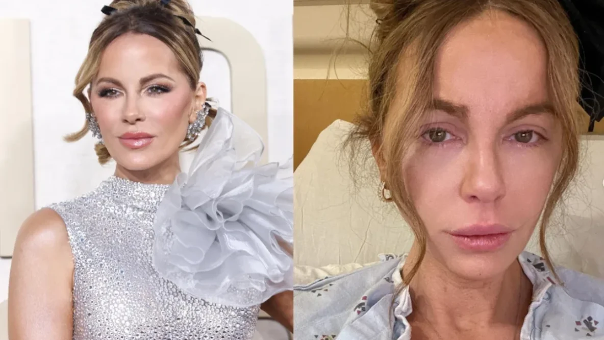 Kate Beckinsale a partagé des photos alarmantes sur Instagram, révélant son hospitalisation dans un état méconnaissable. Les détails chocs et les réactions des fans à découvrir ici.